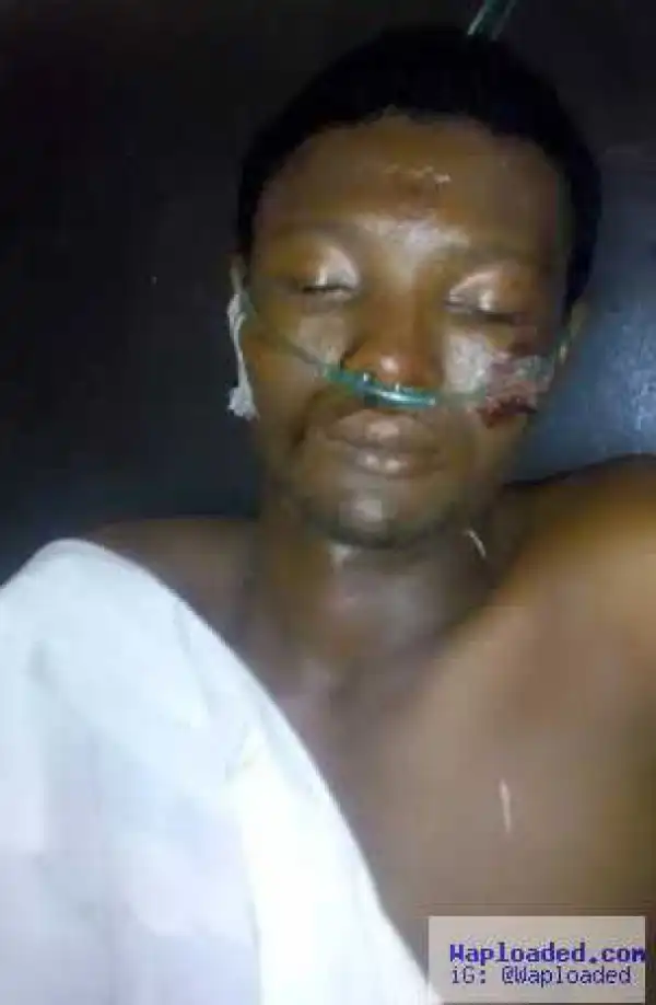 Victim of auto accident is currently in coma at ABUTH and needs identification (photo)